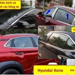 Nẹp chân kính và cong kính