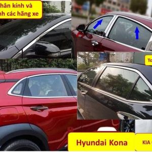 Nẹp chân kính và cong kính